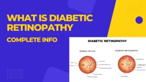 diabetic retinopathy